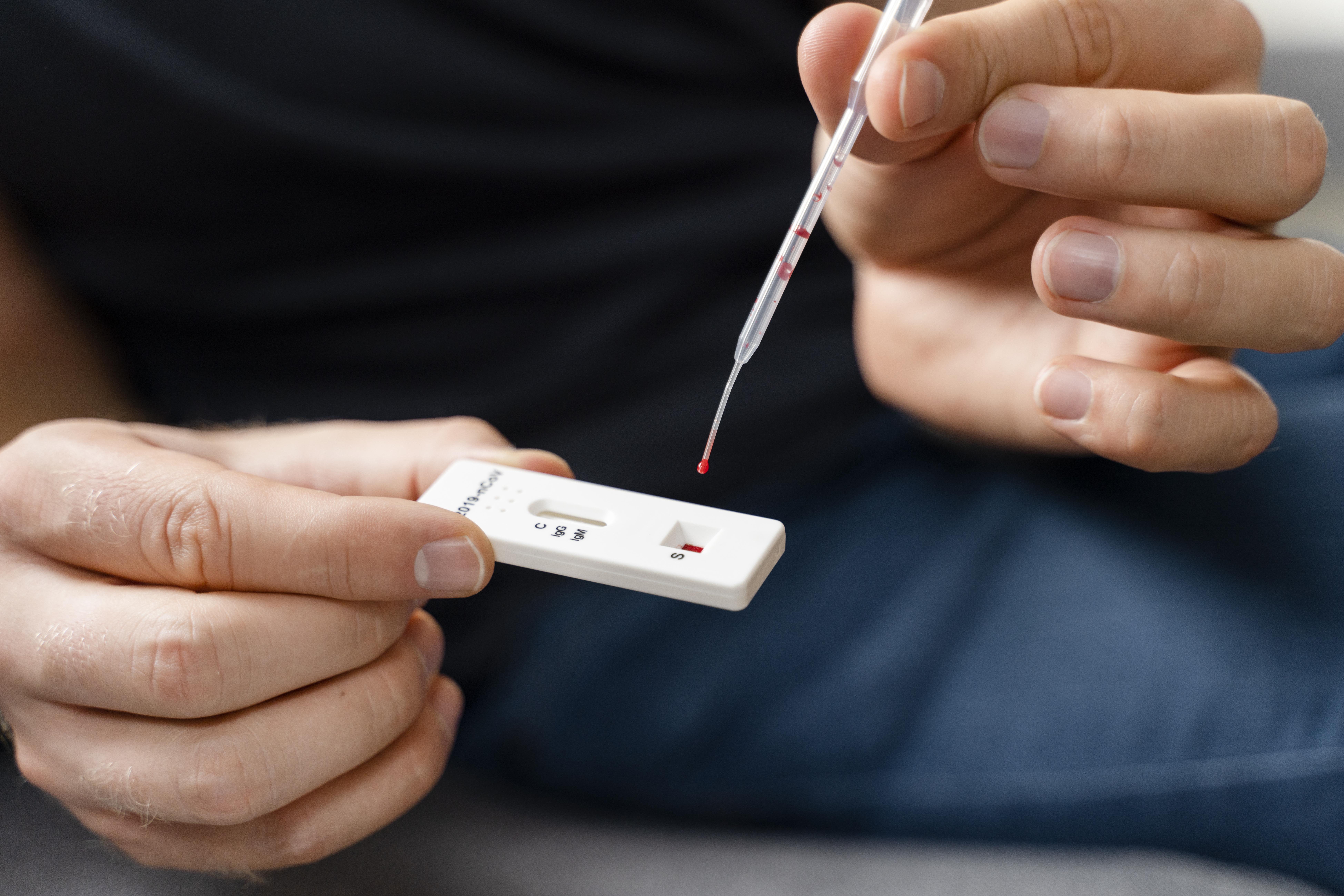 Rapid HIV Testing
